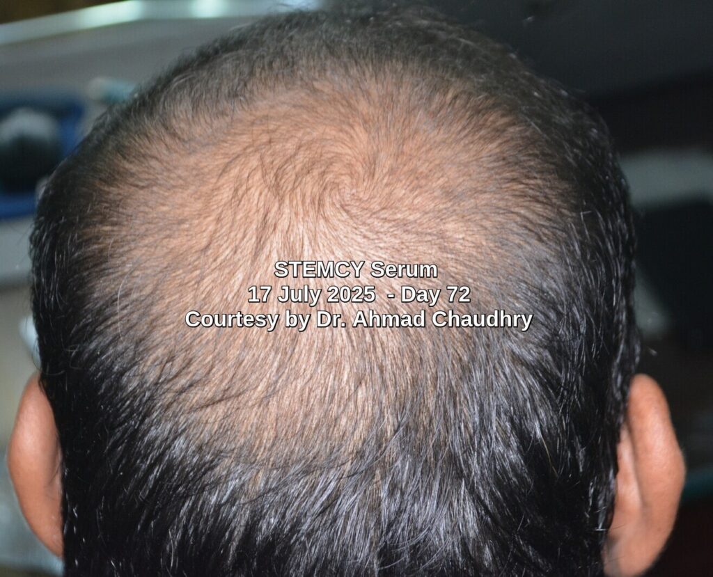Best stem cell activator serum results
